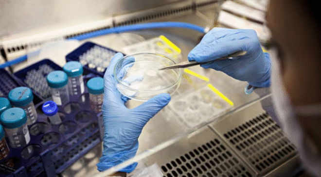 Trasplante de células madre logra curación de VIH; es el resultado de más de una década de investigación internacional