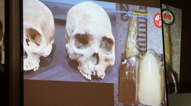 Para identificar a más de 75 mil cuerpos se necesitan 150 años, señalan expertos forenses; resaltan falta de recursos en oficinas y fiscalías