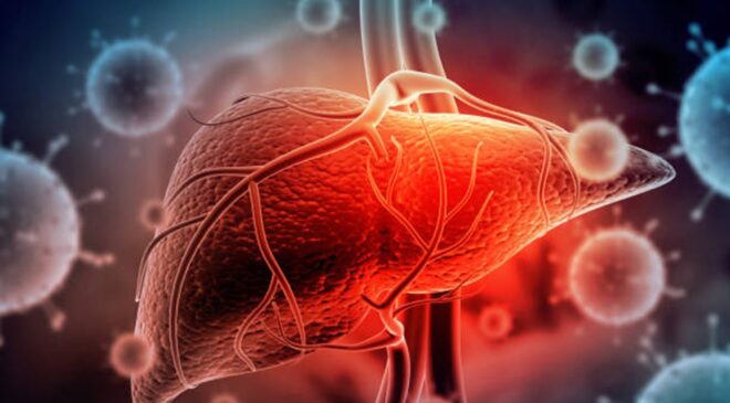 Engaña la enfermedad Hepatitis B con síntomas de males estomacales: advierte especialista de la UAEH