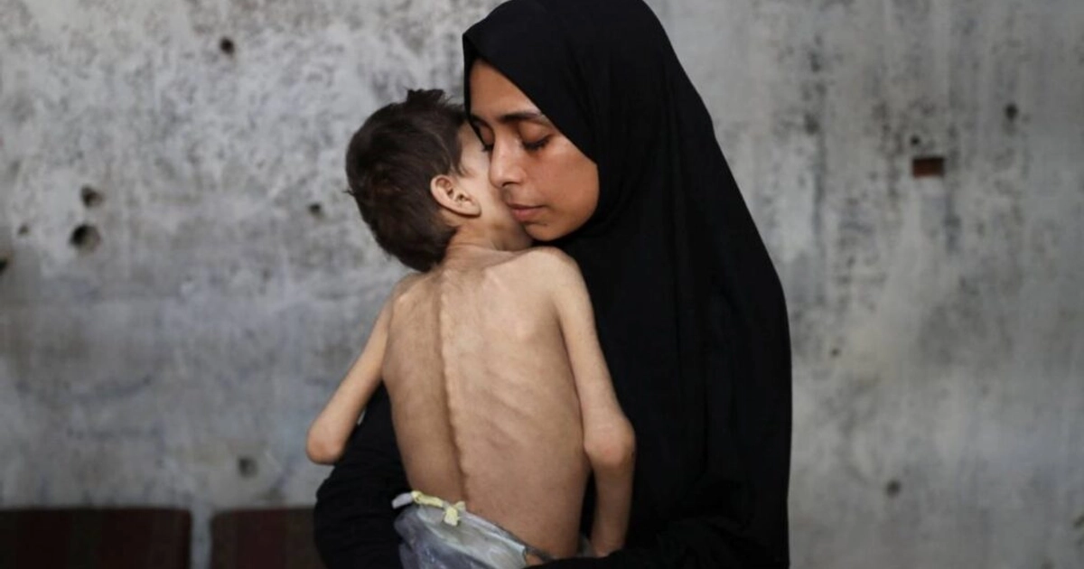 Una mujer y un niño desnutrido en Gaza. Foto: Reuters
