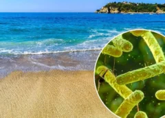 ¿Bacteria “come carne” está presente en México?; conoce qué es, sus síntomas y cómo se contagia