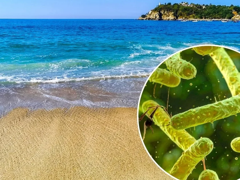 ¿La Bacteria “come carne” llegó a México?; conoce qué es, sus síntomas y cómo se contagia. Foto: Canva