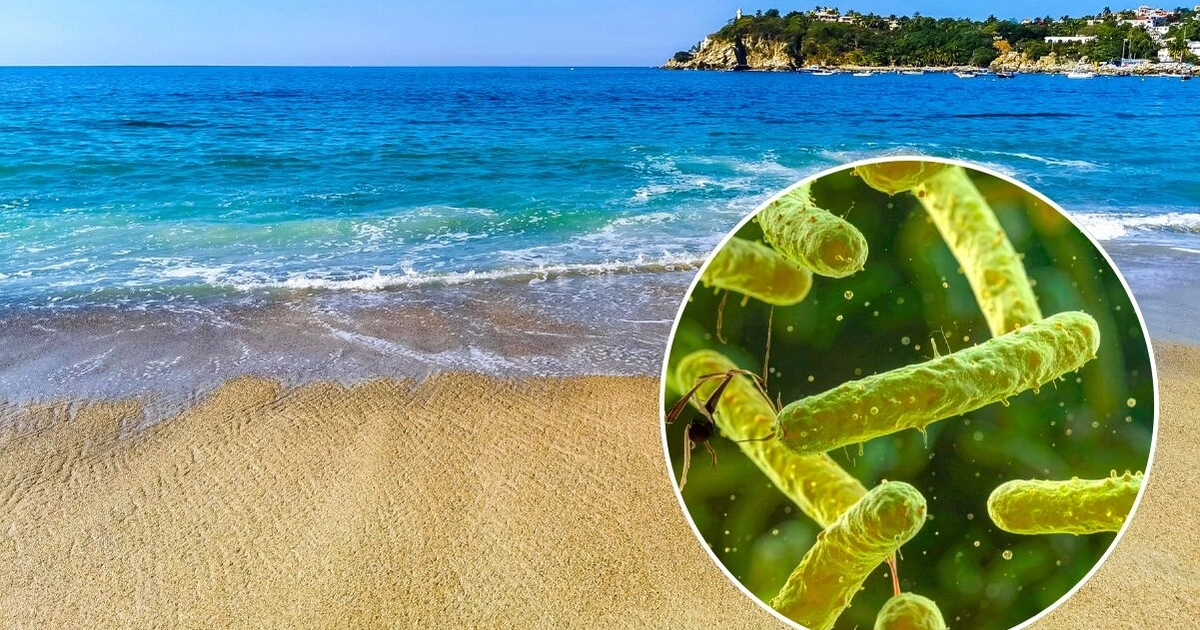 ¿La Bacteria “come carne” llegó a México?; conoce qué es, sus síntomas y cómo se contagia. Foto: Canva