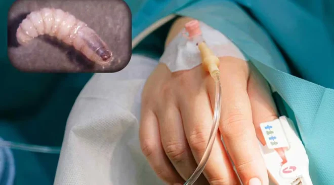 Alerta sanitaria: Casos de gusano barrenador en humanos se quintuplican y México suma 692 contagios