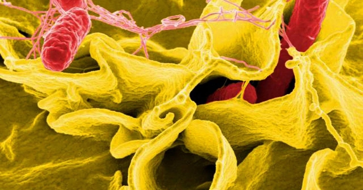 Los análisis referidos por el hospital apuntan a Salmonella spp. y en al menos dos casos a coinfección con Escherichia coli enterotoxigénica. (CDC PUBLIC HEALTH IMAGE LIBRARY)