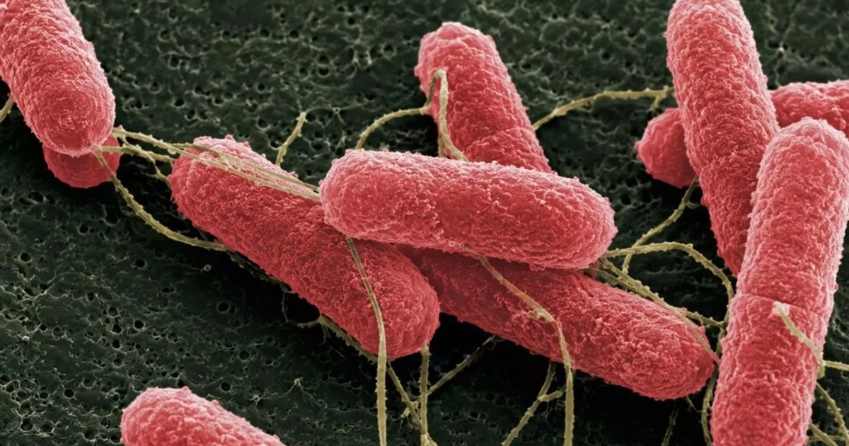 Escherichia coli: puede causar sepsis y meningitis neonatal. Algunas cepas producen BLEE o tienen resistencia a aminoglucósidos y cefalosporinas de tercera generación. (INTA)